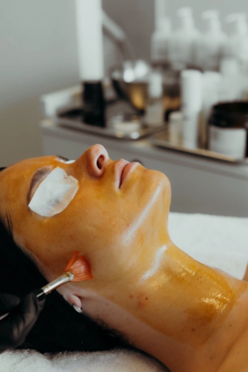 Chemical Peels